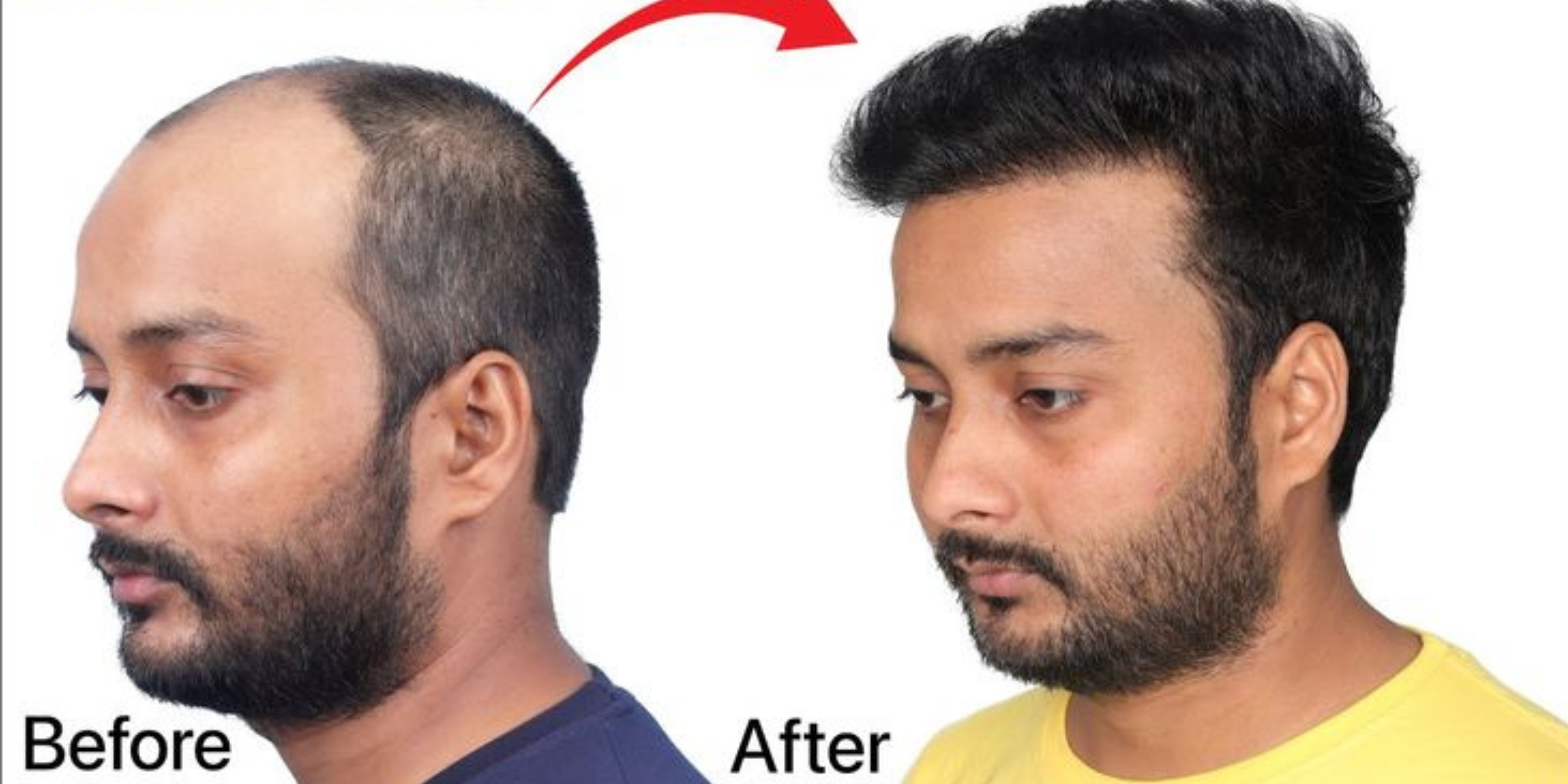 Before and After 3